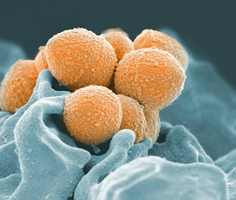 Photo by National Institute of Allergy and Infectious Diseases