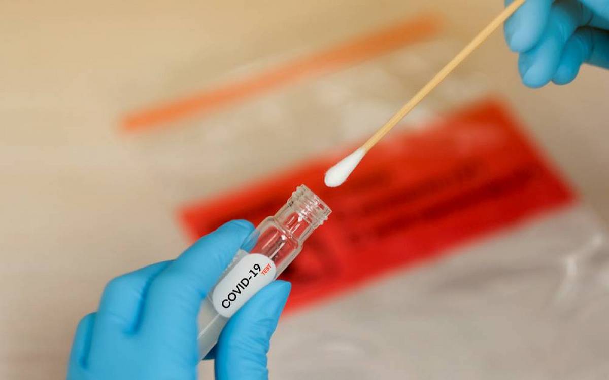 Testy došly aneb další zádrhel vlády, která nařídila povinné testování ve firmách Testy došly aneb další zádrhel vlády, která nařídila povinné testování ve firmách