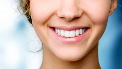 Získejte hollywoodský úsměv: Které metody na bělení zubů fungují a na které raději zapomenout?