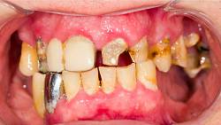 Která znamení si nečistí zuby? 4 znamení, která by se o svůj chrup měla starat více