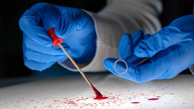 KVÍZ: Troufli byste si na forenzní vědy? Krev, otisky a DNA jsou jen začátek