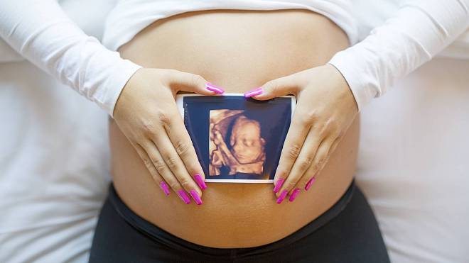 Komu je podobné dítě v bříšku? 3D ultrazvuk vám to ukáže
